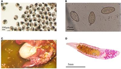 Identification of Myoferlin, a Potential Serodiagnostic Antigen of Clonorchiasis, via Immunoproteomic Analysis of Sera From Different Infection Periods and Excretory-Secretory Products of Clonorchis sinensis